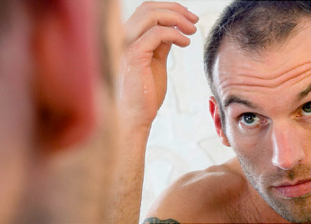 Hair Care: 3 Treatments for Falling Hair That Really Work